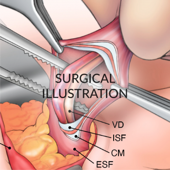 HomepageThumbnailswText_SurgicalIllustration_thumbnail